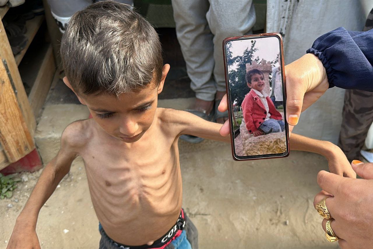 Child affected by conflict showing earlier photo
